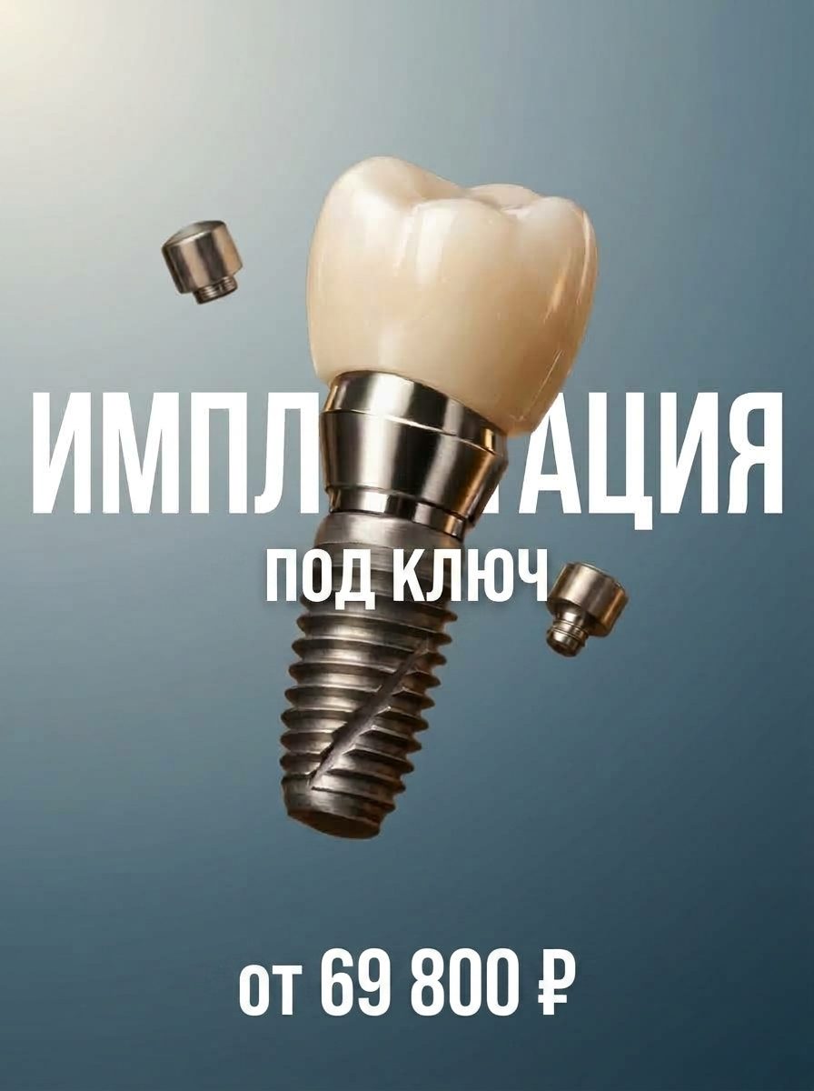 Имплантация «под ключ» — от 69 800 ₽